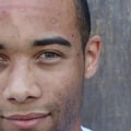 Dark Spot Treatments for Men: Achieve Clear and Healthy Skin