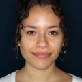What skincare should a 25 year old use?