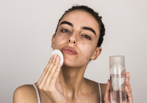What is the #1 way to get rid of acne?