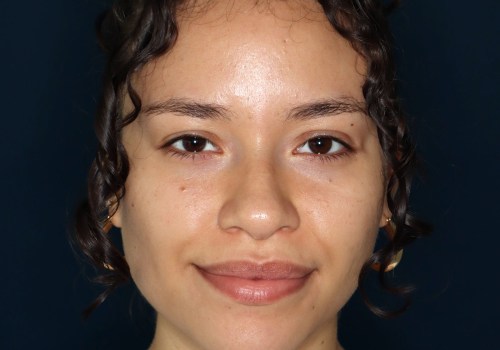 What skincare should a 25 year old use?